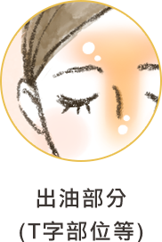 べたつく部分 (Tゾーンなど)